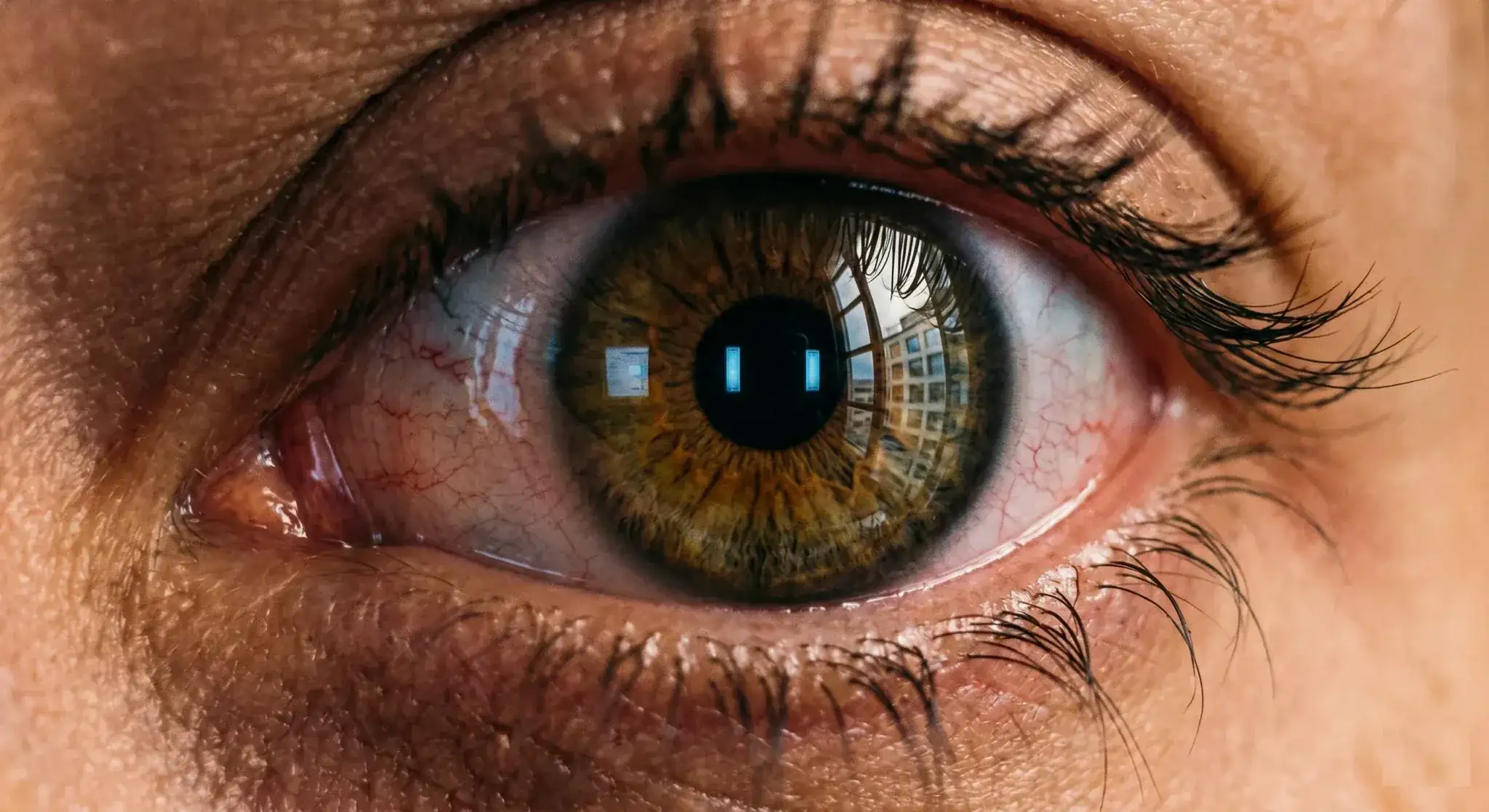 Cross-section of the retina showing macular pigment shielding the central cells