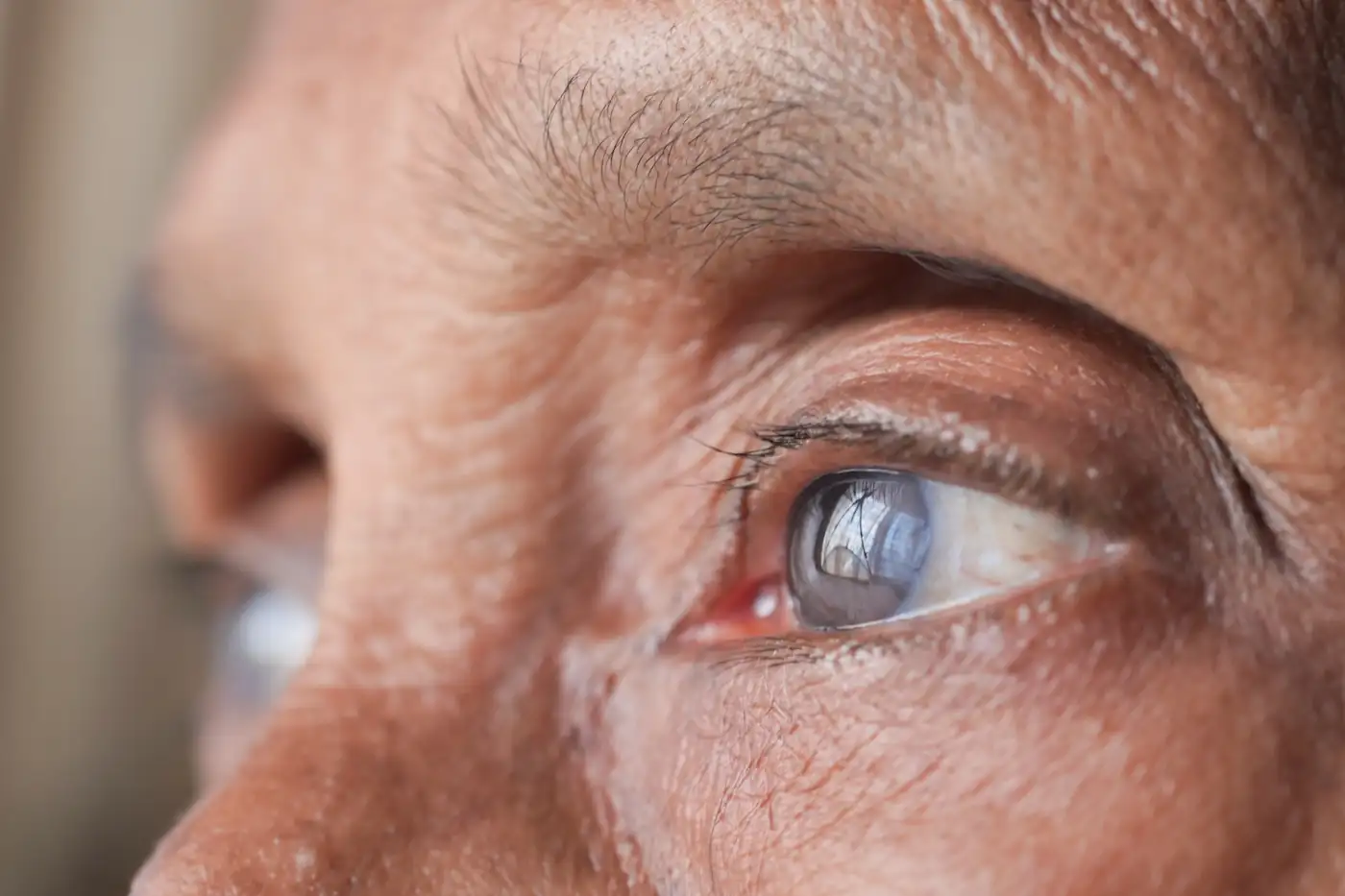Close-up of a mature adult's eye
